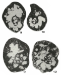 Globochernella braibanti Hance, 1983