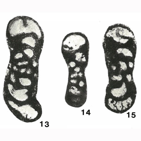 Quasiendothyra rotai Brazhnikova, 1962 Quasiendothyra rotai Brazhnikova, 1962