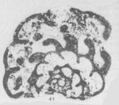 Syntype of Cribroparaendothyra simonovae Lipina in Rauzer-Chernousova et al., 1996 identified as P. portentosa in Hance et al. (2011), author: Le Coze, François