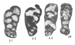 Globispiroplectammina mameti Vachard, 1977