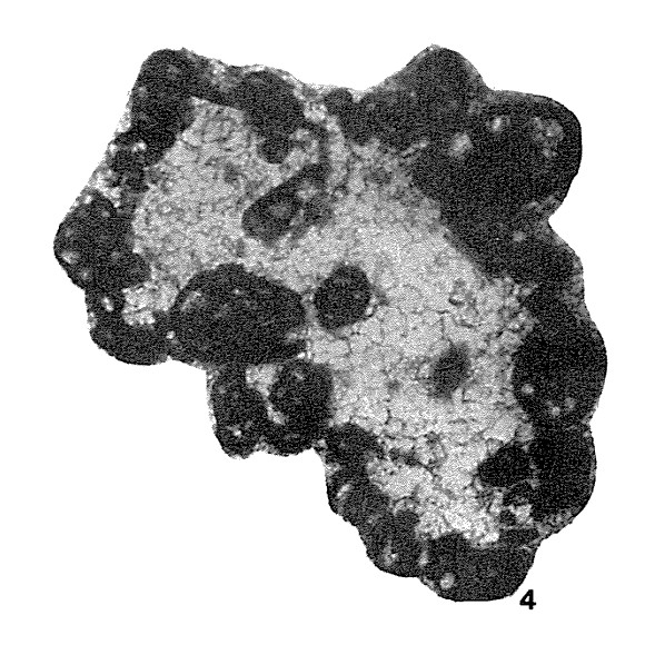 Ammobaculites horridus Brazhnikova, 1967 Ammobaculites horridus Brazhnikova, 1967