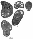 Paremiratella robusta Gaillot & Vachard, 2007