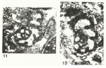 Endothyranella kocaeliensis Dager, 1978