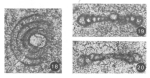 Monotaxinoides caprariensis Vachard, 1977