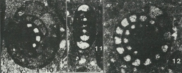 Nautiloculina oolithica Mohler, 1938 Nautiloculina oolithica Mohler, 1938