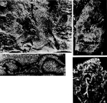Chromista - Foraminifera (foraminifers)