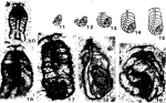 Siphonofera pilleri Senowbari-Daryan, 1983
