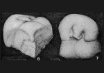 Valvulina triangularis d'Orbigny in Guérin-Méneville, 1832