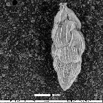 Uvigerinella californica subsp. ornata (Cushman, 1926)