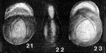 Pseudopolymorphinoides limburgensis van Bellen, 1946