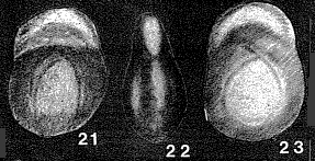 Pseudopolymorphinoides limburgensis van Bellen, 1946 Pseudopolymorphinoides limburgensis van Bellen, 1946