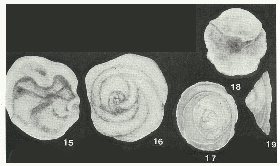Patellovalvulina patruliusi Neagu, 1975 Patellovalvulina patruliusi Neagu, 1975