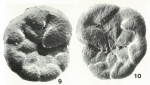 Asteroparatrochammina towei Brönnimann & Zaninetti, 1984