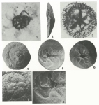 Bruneica clypea Brönnimann, Keij & Zaninetti, 1983