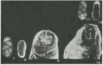 Talimuella merosa Zeng & Li, 1982
