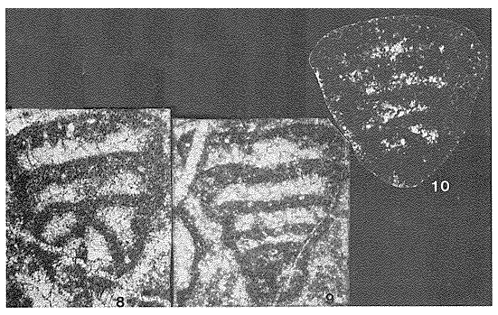 Palaeolituonella majzoni Bérczi-Makk, 1981 and Palaeolituonella meridionalis (Luperto, 1966) Palaeolituonella majzoni Bérczi-Makk, 1981 and Palaeolituonella meridionalis (Luperto, 1966)