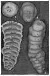 Cribrogoesella robusta (Brady, 1881)