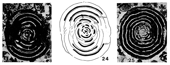 Hemigordiopsis renzi Reichel, 1945 Hemigordiopsis renzi Reichel, 1945