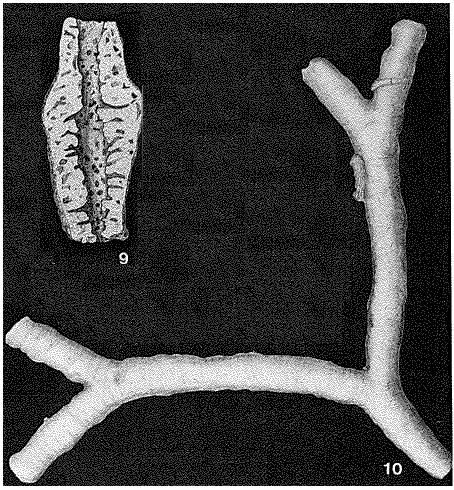 Schizammina labyrinthica Heron-Allen & Earland, 1929 Schizammina labyrinthica Heron-Allen & Earland, 1929