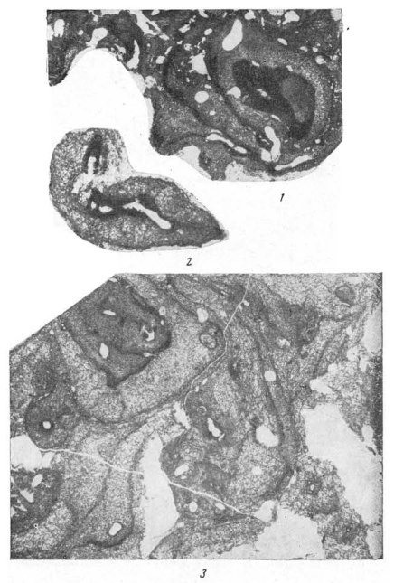 Tubiphytes obscurus Maslov, 1956 Tubiphytes obscurus Maslov, 1956
