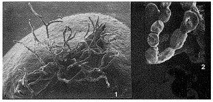 Septuma ocotillo Tendal & Hessler, 1977, author: Loeblich & Tappan, 1987