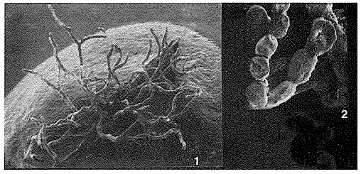 Septuma ocotillo Tendal & Hessler, 1977