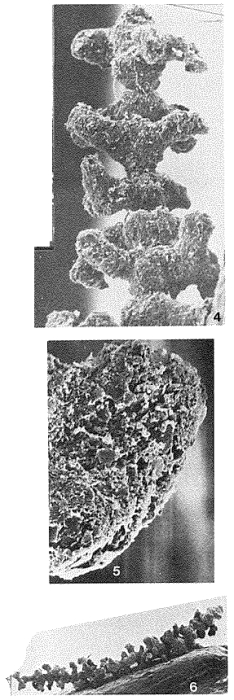 Baculella globofera Tendal & Hessler, 1977 Baculella globofera Tendal & Hessler, 1977