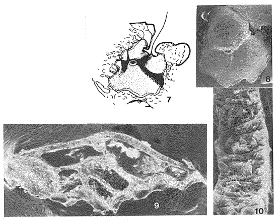 Ammotrochoides bignoti Janin, 1984