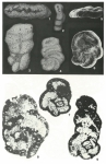 Buccicrenata subgoodlandensis (Vanderpool, 1933)