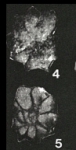 Woodella granosa Haque, 1956