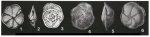 Epistominella pulchella Husezima & Maruhasi, 1944