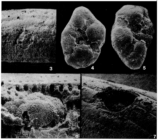 Planorbulinopsis parasita Banner, 1971 Planorbulinopsis parasita Banner, 1971