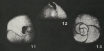 Haerella conica Belford, 1960