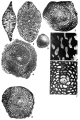 Helicolepidina spiralis (Tobler, 1922), author: Loeblich & Tappan, 1987