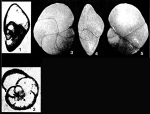 Spirotecta pellicula Belford, 1961