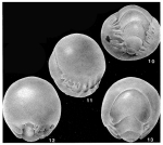 Chilostomellina fimbriata Cushman, 1926