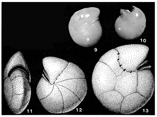 Spirotectina crassa Saidova, 1975