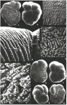 Trichohyalus bartletti (Cushman, 1933)