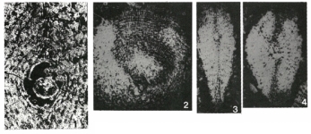 Rhabdorbitoides hedbergi Brönnimann, 1955, author: Loeblich & Tappan, 1987