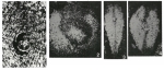 Rhabdorbitoides hedbergi Brönnimann, 1955