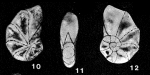 Stomoloculina multangula He, Hu & Wang, 1965