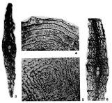 Pseudophragmina floridana (Cushman, 1917), author: Loeblich & Tappan, 1987