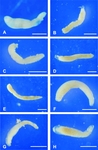Bowseria arctowskii Sinniger, Lecroq, Majewski & Pawlowski, 2008