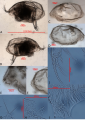 Holotype of Euphilomedes biacutidens Xiang??, Ye?, Chen, Chen & Lin, 2017, author: Costa, Victor Messias de Maco
