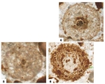 Protogypsina indica Matsumaru & Sarma, 2010