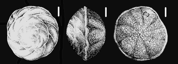 Porosorotalia makiyamae (Chiji, 1961) holotype Porosorotalia makiyamae (Chiji, 1961) holotype