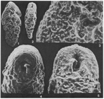 Abditodentrix pseudothalmanni (Boltovskoy & Guissani de Kahn, 1981)