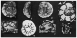 Krikoumbilica pileiformis He, 1984