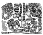 Cyclopseudedomia klokovaensis (Fleury, 1979)