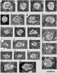Rotalispira scarsellai (Torre, 1967)